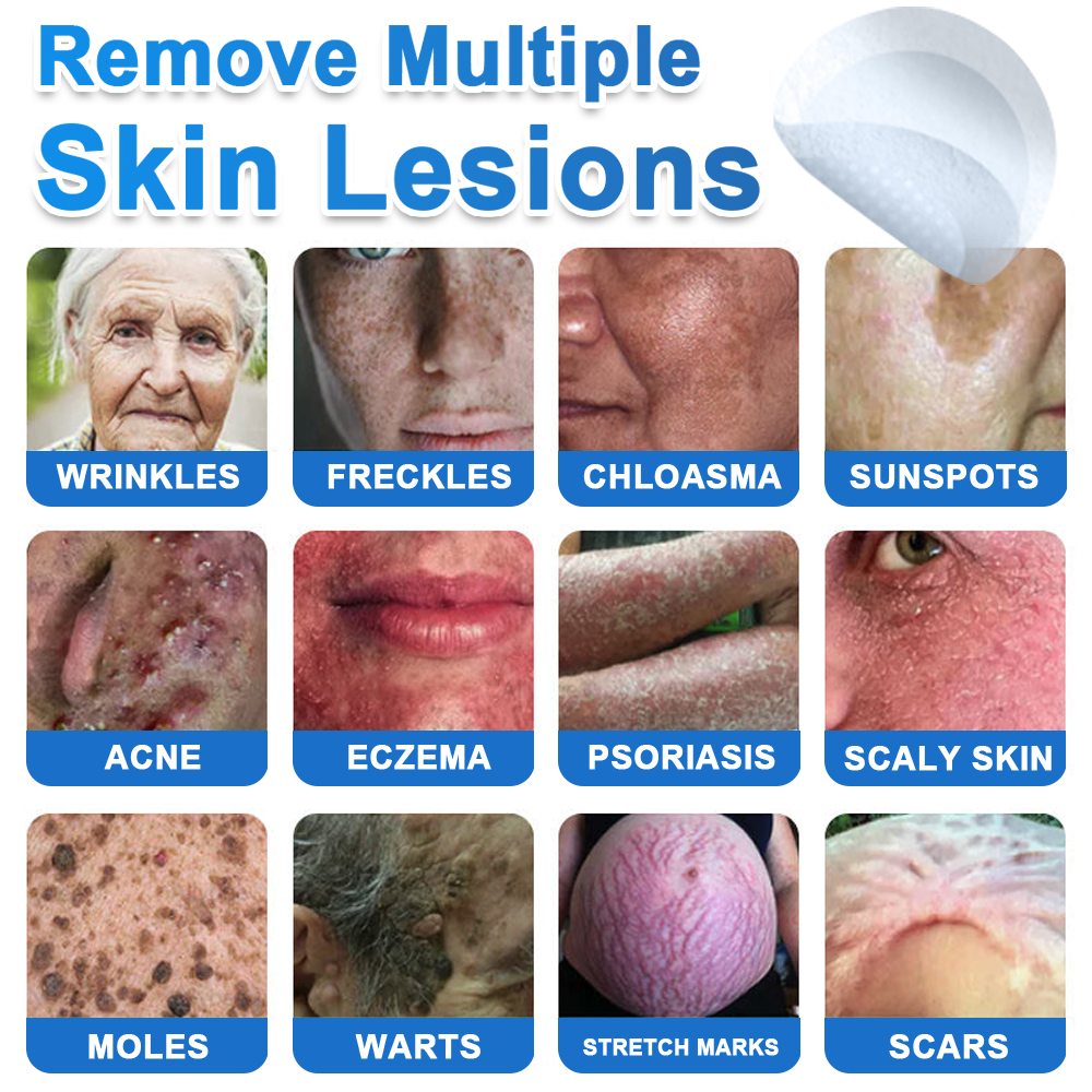 🧑‍⚕️GFOUK® 2026 Newly Upgraded 2-in-1 Microneedle Hydrocolloid Patches | Removes Raised Moles, Acne, Flat Warts, and Skin Tags | Improves Wrinkles, Scars, and Blemishes | Invisible Acne Patches for Face & Body