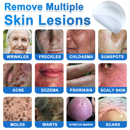 🧑‍⚕️GFOUK® 2026 Newly Upgraded 2-in-1 Microneedle Hydrocolloid Patches | Removes Raised Moles, Acne, Flat Warts, and Skin Tags | Improves Wrinkles, Scars, and Blemishes | Invisible Acne Patches for Face & Body
