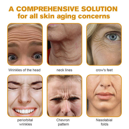 (🌤️Historical low price✅) Furzero™ Botox Bee Venom Wrinkle Removal Cream- LAST DAY 70% OFF