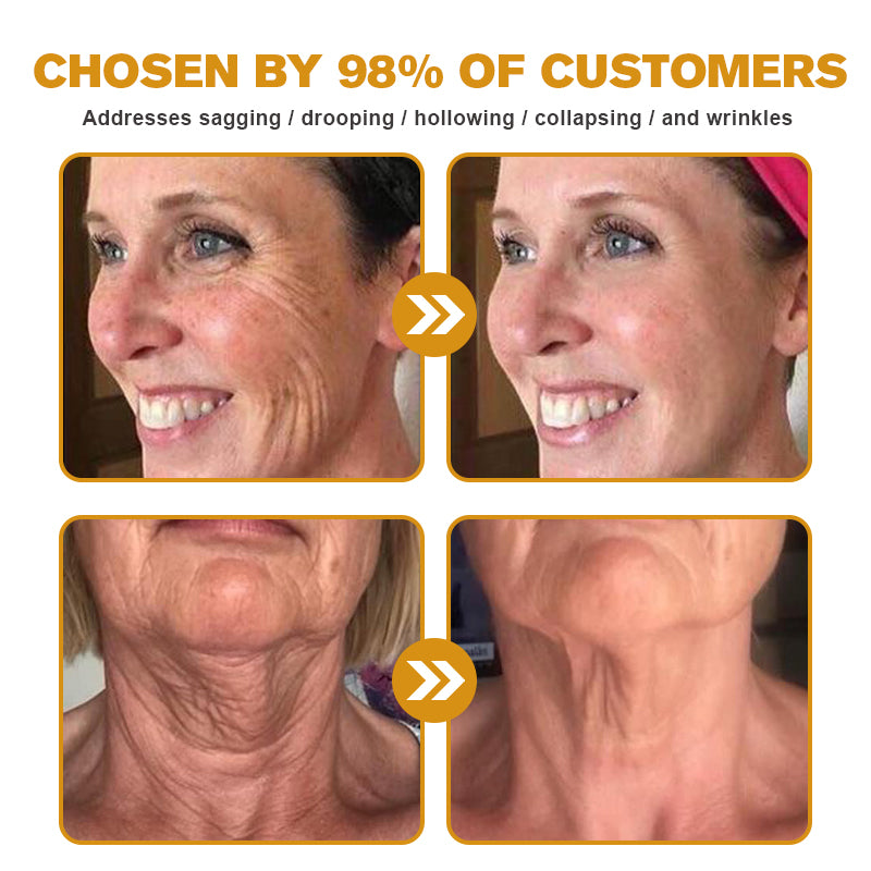 (🌤️Historical low price✅) Furzero™ Botox Bee Venom Wrinkle Removal Cream- LAST DAY 70% OFF