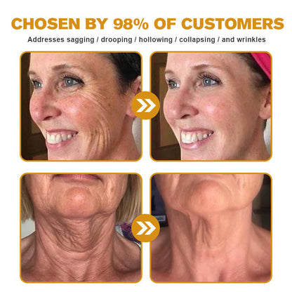 (🌤️Historical low price✅) Furzero™ Botox Bee Venom Wrinkle Removal Cream- LAST DAY 70% OFF