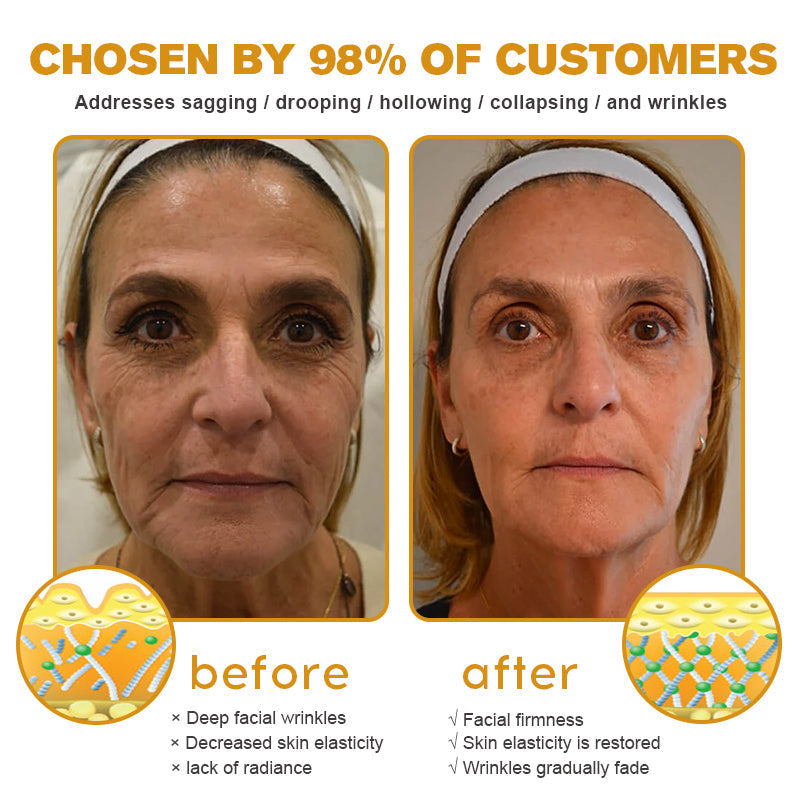 (🌤️Historical low price✅) Furzero™ Botox Bee Venom Wrinkle Removal Cream- LAST DAY 70% OFF