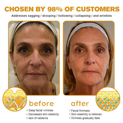 (🌤️Historical low price✅) Furzero™ Botox Bee Venom Wrinkle Removal Cream- LAST DAY 70% OFF